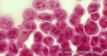 Bristolians urged to get tested as gonorrhoea cases continue to rise