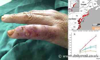 Scientists sound alarm over flesh-eating bacteria expected to DOUBLE in next 20 years