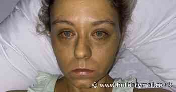 'It's amazing' Student who desperately needs kidney transplant astonished as 400 offer to be tested