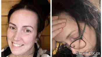 N.B. woman spent 20 years in pain, now she's ready to get her life back