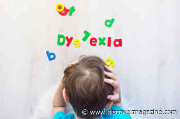 4 Things You Didn’t Know About Dyslexia