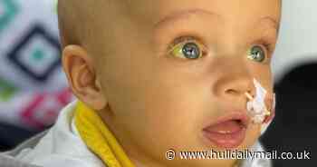 Baby born with no gallbladder so yellow he looked like he'd been 'coloured in with a highlighter', mum says