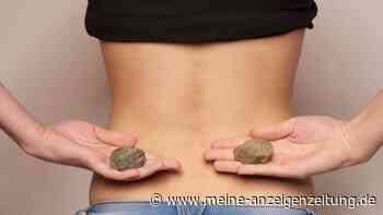 Nierensteine: Fünf Risikofaktoren können die Ablagerungen verursachen