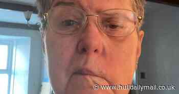 Woman's 'disaster operation' to remove brain tumour caused facial disfigurement