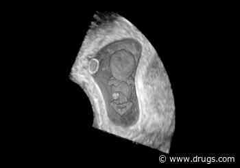 New Clues to Early Miscarriage and How to Predict Them