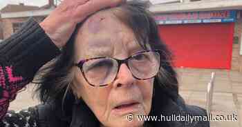 Gran-of-six bruised and battered after being 'knocked over' by boy on e-scooter