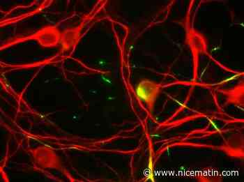 La recherche de nouveaux antidouleurs dopée par une technique mise au point par des chercheurs niçois