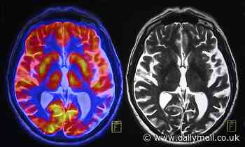 Forgetful or dementia? Neuroscientist reveals the five signs you should never ignore