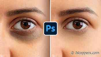 How to Get Rid of Dark Circles Under Eyes Using Photoshop