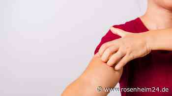 Juckreiz: Beliebtes Hausmittel kann zur Linderung beitragen