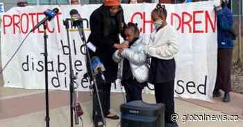 Girl’s severed finger leads mother to sue Hamilton public school board for $1M