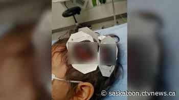 Dog that attacked five-year-old Saskatoon boy involved in three other attacks