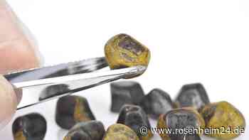 Kranke Galle durch Gallensteine: Welche Symptome neben starker Oberbauchschmerzen Sie zum Arzt führen sollten