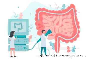 Colon Cancer Screening: How to Prevent Colon Cancer
