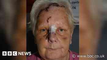 Blackburn woman left terrified over neighbour dog attack