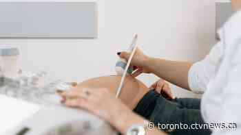 Uninsured patients denied scheduled C-sections unless they pay $6,000, midwife says