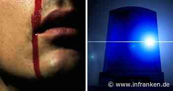 Coburg: Passanten melden blutverschmierten Mann in der Innenstadt - offene Wunde am Hals