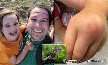 Girl, 3, is bitten by iguana who ran off with her cake