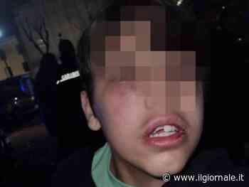Pestato con un tirapugni dai coetanei: l'orrore su un bimbo di 11 anni