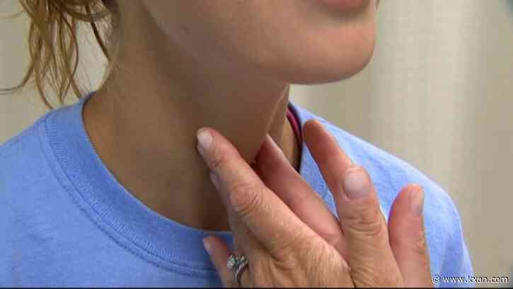Strep A infections spike across Texas; how to protect yourself