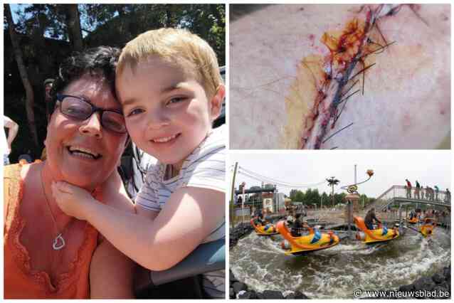 “Dit kon zoveel erger zijn”: Christel (54) liep zware verwondingen op aan arm bij ongeluk op Mega Mindy jetski in Plopsaland