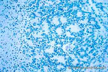 Novel Treatment Shows Promise Against Rare Cancer in Kids