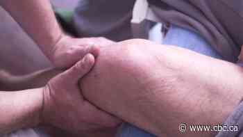 Manitoba hip, knee replacement patients will be covered for physio at all providers after billing model change