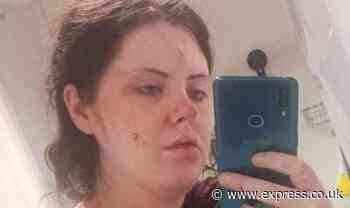 Pregnant woman slashed in stomach by ex who threatened to carry out DIY C-section