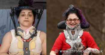 Cramlington woman with rare condition reveals how risky operations saved and changed her life