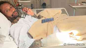 Despite losing part of his hand, former Winnipeg tattoo artist determined to stay positive