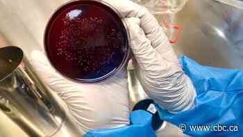 Whooping cough has spread across province: Alberta Health Services