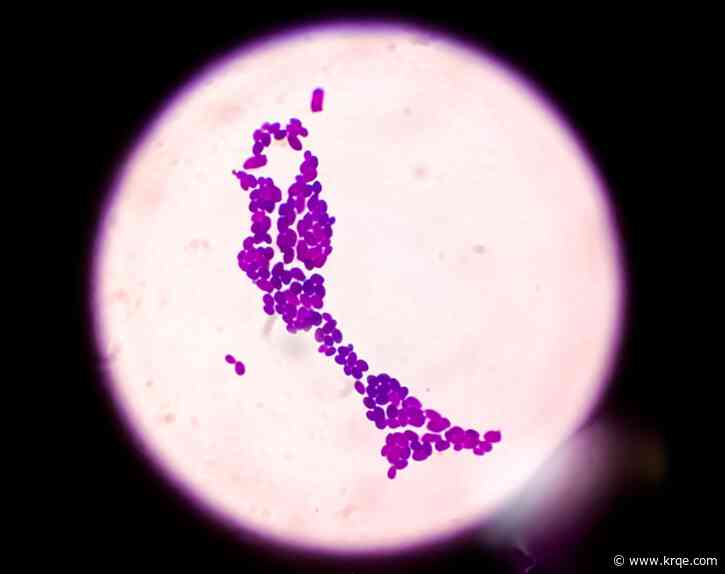 What are the symptoms of Candida auris, the drug-resistant fungus spreading in 28 states?