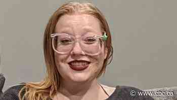 Parents of Ontario woman who suffered severe burns from a street tent fire urge action on homelessness