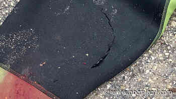 Wind Surfer Hospitalized After Being Bitten Near Virginia Key