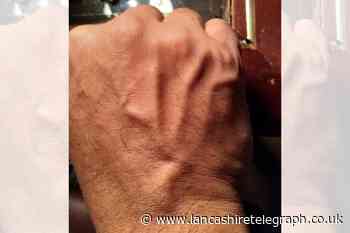 Man claims to see ‘Allah’ written in veins on back of hand
