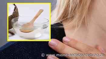 Juckende Kopfhaut – welche Hausmittel gegen Schuppen helfen