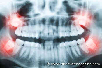 5 Vestigial Body Parts Found in Humans