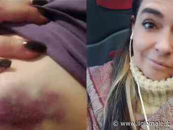 Picchiata dal branco per aver difeso l'amica: "Nessuno è intervenuto"