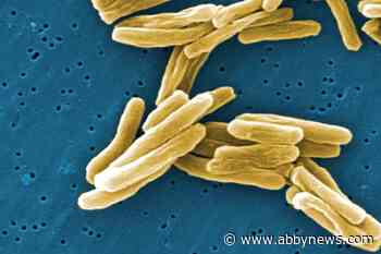 COVID-19 pandemic stalled progress on eliminating tuberculosis among Inuit: officials