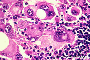 mRNA cancer vaccine an 'exciting' advance in reducing risk of melanoma relapse, trial shows