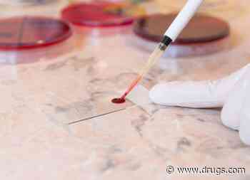 Blood-Based 'Liquid Biopsy' Might Spot Early-Stage Cancers