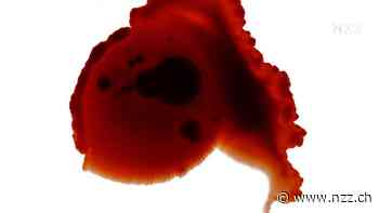 Krebs entdecken, bevor er wirklich da ist