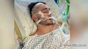 Alex Fletcher: Bath City striker on impact of life-threatening skull injury