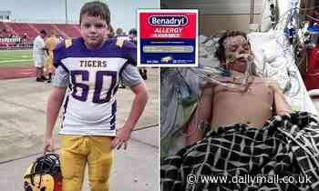 Teen died after overdosing on Benadryl as part of viral TikTok ...