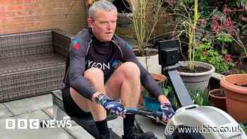 Bowel cancer survivor urges others to take up screening offers