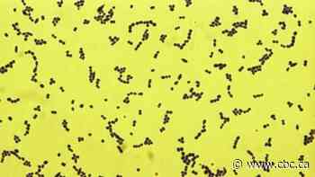 Spike in severe illness caused by strep A bacteria is 'global phenomenon' — including in Canada