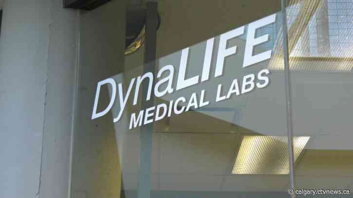 AHS addressing lengthy wait times at Calgary and area Dynalife locations