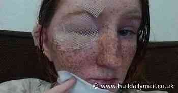 Man poured boiling kettle over sister, melting her face, in row about rat