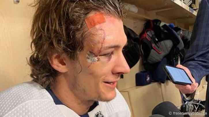 Jets forward Barron weighs in on recovery after taking skate to the face in Game 1