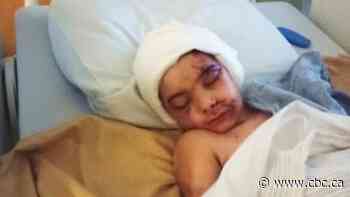 Dog killed, boy injured in pair of attacks involving dogs from same home